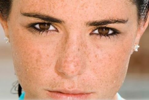 成都米蘭柏羽隆鼻兼雙眼皮，讓眼鼻美麗動(dòng)人