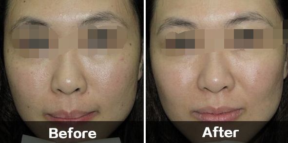 長沙針雕祛細紋整形醫(yī)院推薦：10家口碑卓著的選擇