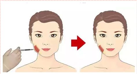 無錫脂肪隆鼻口碑榜單：10家實(shí)力整形機(jī)構(gòu)精細(xì)解讀