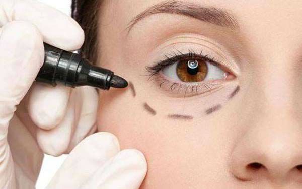 胸部整形失敗修復(fù)術(shù)，再無后顧之憂