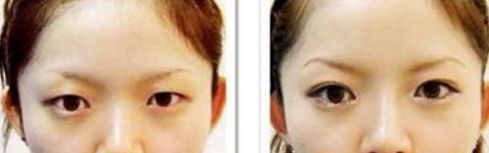 青島口碑較好的除頸紋醫(yī)院10家名單一覽