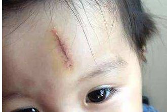 中山祛痘醫(yī)院實力排名：2024年口碑TOP10精選