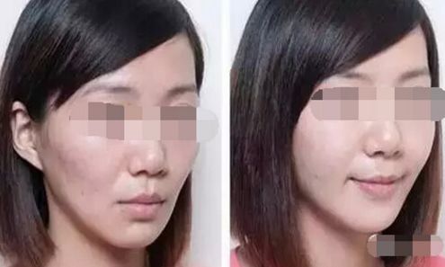 延吉口碑佳的無(wú)創(chuàng)美容整形醫(yī)院盤點(diǎn)