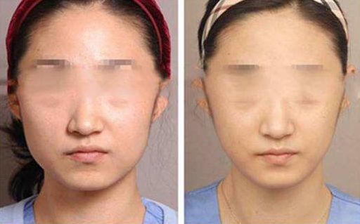 重慶哪家醫(yī)院填充玻尿酸效果好？前10強(qiáng)醫(yī)療美容機(jī)構(gòu)解答！