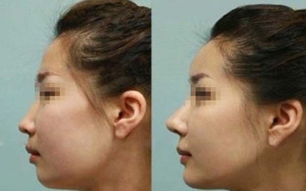 青島專業(yè)脈沖強(qiáng)光去紅血絲醫(yī)院排行榜TOP10