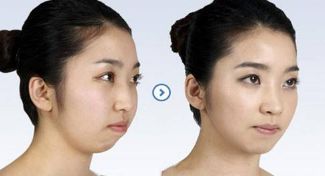 2024成都頸部皺紋提拉手術(shù)十佳醫(yī)療美容醫(yī)院榜單揭曉！