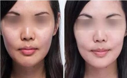 廣州生殖器整形醫(yī)院實力口碑排行：助你重拾自信！