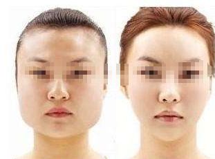 鹽城激光祛疤效果好的美容醫(yī)院推薦，哪家值得信賴？