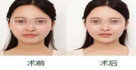 貴陽(yáng)飛頓醫(yī)院：彩光口碑技術(shù)全揭秘！