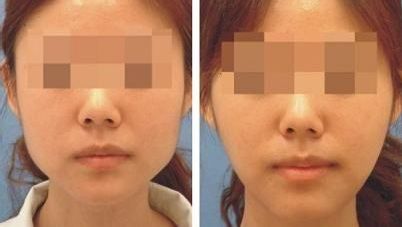 長春變性手術醫(yī)院哪家好？來看看明星推薦種草榜