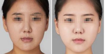 珠海祛魚尾紋整形美容醫(yī)院前十推薦：公立與私立對比