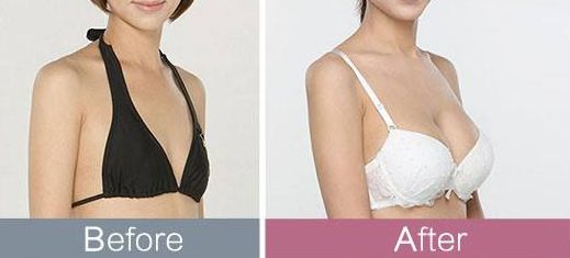 桂林前十強(qiáng)上臉下垂美容醫(yī)院大盤點