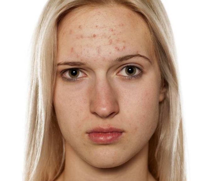 合肥去眼睛細紋醫(yī)院實力排行榜Top 10