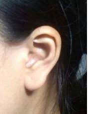 南昌哪家醫(yī)院口碑好？肉毒素填充眼紋排行榜前十！