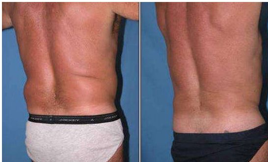 石家莊哪家醫(yī)院治法令紋效果比較好？排名前十大揭曉！