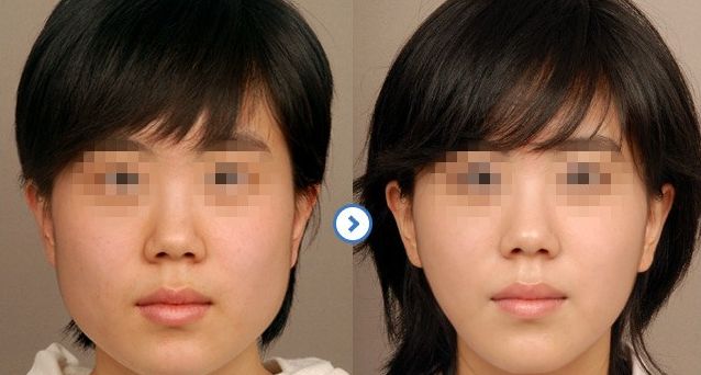 北京皮秒洗眉整形醫(yī)院推薦：10家技術(shù)精湛，值得信賴！