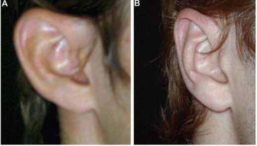 青島哪些美容院可提供專業(yè)的清潔皮膚服務(wù)？