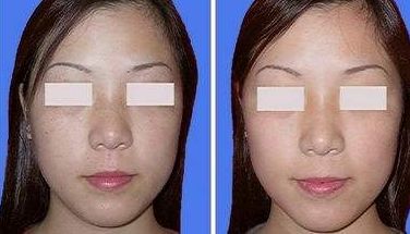 河北中醫(yī)按摩權(quán)威醫(yī)院排名及口碑解析，前10強(qiáng)醫(yī)院實(shí)力盤點(diǎn)！