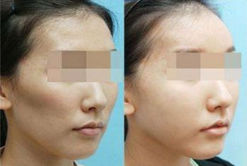 威海十佳鼻部塑形醫(yī)院口碑排行榜