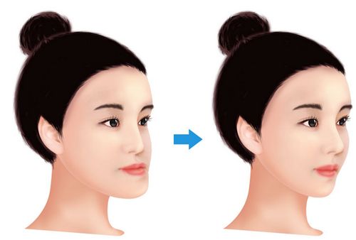 寧波大學(xué)醫(yī)學(xué)院附屬醫(yī)院美容整形外科怎么樣？?jī)r(jià)格收費(fèi)及口碑分享！