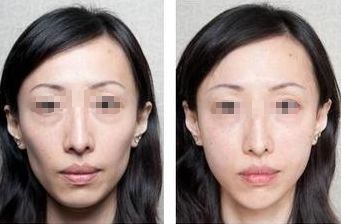 半紋眉價(jià)格查詢，讓無眉大俠來一探究竟吧！