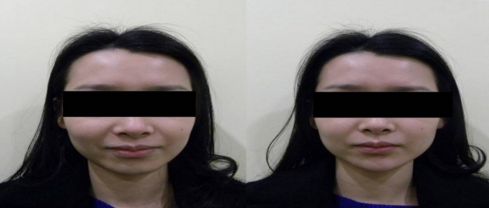 天津口碑佳的十家私立美容醫(yī)院推薦：告別細紋，重現(xiàn)年輕光彩