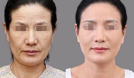 邵陽(yáng)淚溝填充醫(yī)院推薦：口碑十佳機(jī)構(gòu)實(shí)力見證