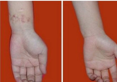 朝陽區(qū)專業(yè)眼底紋填充醫(yī)院推薦排行榜 Top10