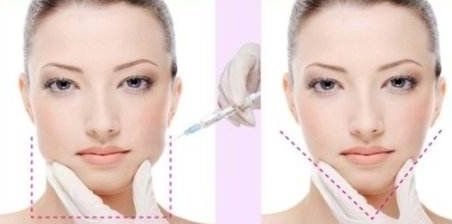 俞翰秀手術技術高超，雙眼皮、隆鼻以外的整形手術也是得心應手