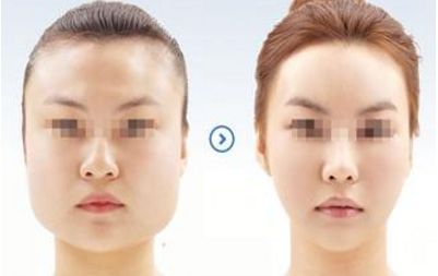 合肥高口碑射頻美容整形機(jī)構(gòu)推薦