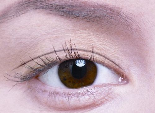 種植發(fā)際線手術后為何會出現水腫現象 術后幾天可洗頭