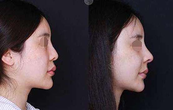 桐廬微針填充醫(yī)院前十推薦：名氣大，效果好，口碑棒