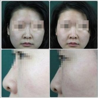 重慶額頭填充整形醫(yī)院口碑排行榜TOP10