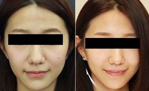 深圳痘痘整形醫(yī)院人氣10強(qiáng)大盤點(diǎn)