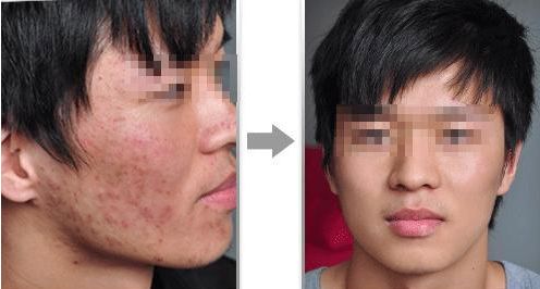 蚌埠哪家吸脂瘦大腿醫(yī)院口碑好？前10排名推薦