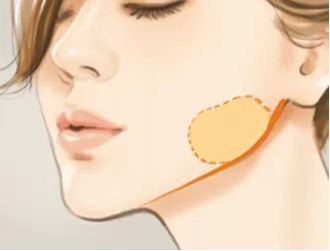 長沙精雕無痕吸脂號(hào)脈：十家美容醫(yī)院親測(cè)報(bào)告