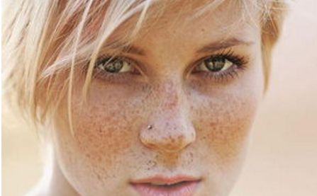 石家莊十家權(quán)威醫(yī)院解讀去除川字紋方法