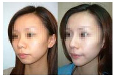 蘭州祛除妊娠紋整形醫(yī)院口碑推薦前10強