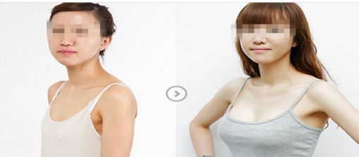 西安去眼周紋口碑榜單：前十家醫(yī)院揭曉