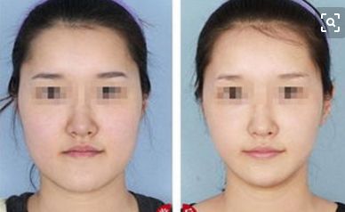 蘇州眼底紋填充十佳整形醫(yī)院實地排名，你需要了解的最新資訊！