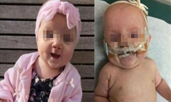 寧波提拉眼角紋醫(yī)院排名前十強(qiáng)！精準(zhǔn)推薦，解決眼角紋難題！