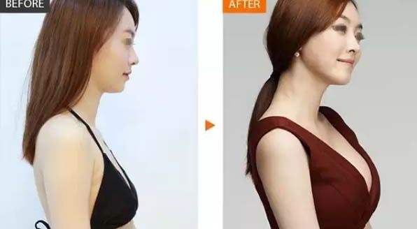 成都頸紋注射十大拔萃醫(yī)院，揭秘技藝流派