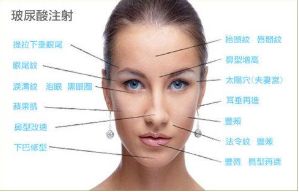 成都自體煥顏醫(yī)院精選前十大熱門項(xiàng)目詳解！