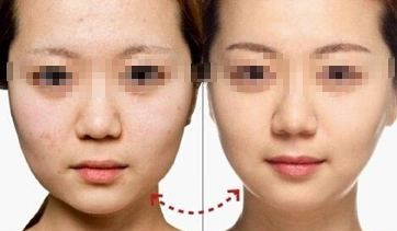 河南眉弓填充整形醫(yī)院口碑實力大盤點