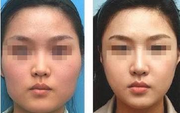 天津十佳眼部整形醫(yī)院權(quán)威榜單