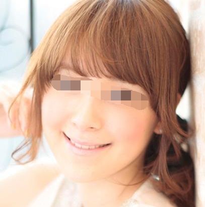 上海鮮紅斑痣微磨術(shù)口碑前十強(qiáng)醫(yī)院推薦