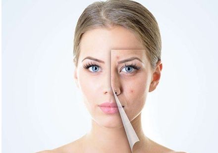 惠州痘印點(diǎn)陣激光醫(yī)院哪家好？10大權(quán)威機(jī)構(gòu)全面解析