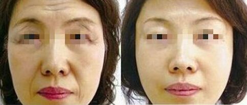 祛斑經(jīng)歷分享：吉林省中醫(yī)院美容科的獨(dú)到方法揭秘