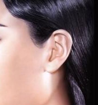 無錫細(xì)胞激光去靜態(tài)紋醫(yī)院排行榜TOP10，用戶口碑大揭秘！