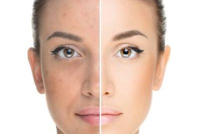 長(zhǎng)沙專(zhuān)業(yè)光雕溶脂瘦腹醫(yī)院排名前十詳解